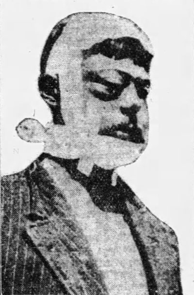A bandaged John Ashley as he appeared after his arrest in the Bank of Stuart robbery, when confederate Kid Lowe discharged a bullet that went into John’s jaw and right eye.