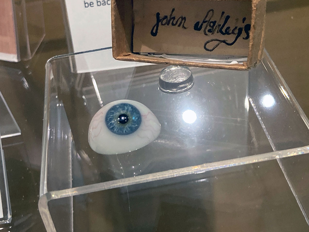 John Ashley was fitted with a prosthetic eye while in prison. The eye is on display at the Ashley Gang exhibit at the Elliott Museum in Stuart.